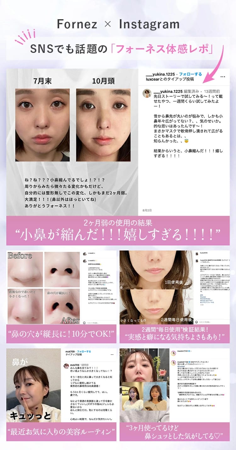 日本直送:LUXGEAR Fornez 鼻專用EMS美顏器 ✨ (充電式|1台)(Z192)
