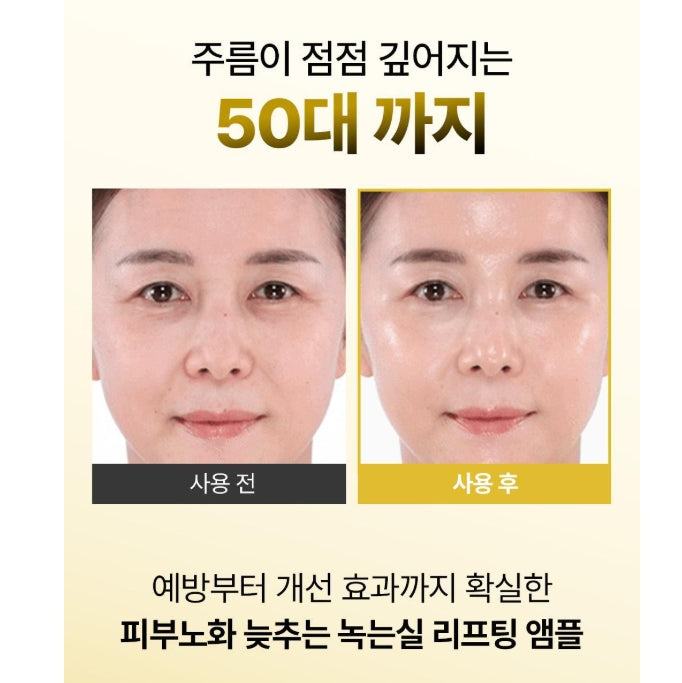 韓國製:Sungboon Editor 專業級密集護理 Silk Peptide Intensive Lifting Ampoule (B523)