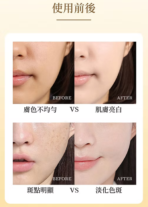 日本製:✈️Cinal EXIA Premium 2000 美白亮肌錠 200粒X2樽 (B3138)