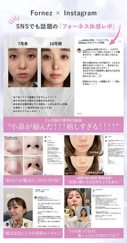 日本直送：LUXGEAR Fornez 鼻專用EMS美顏器 ✨ (充電式｜1台)(Z192)