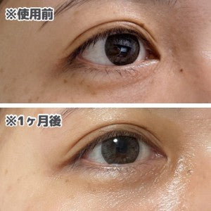 日本製-資生堂-Attenir-艾緹諾-藥用改善皺紋全效眼霜-升級版-植物肉毒桿菌-葉黃素抗藍光-無添加眼部精華-去細紋黑眼圈