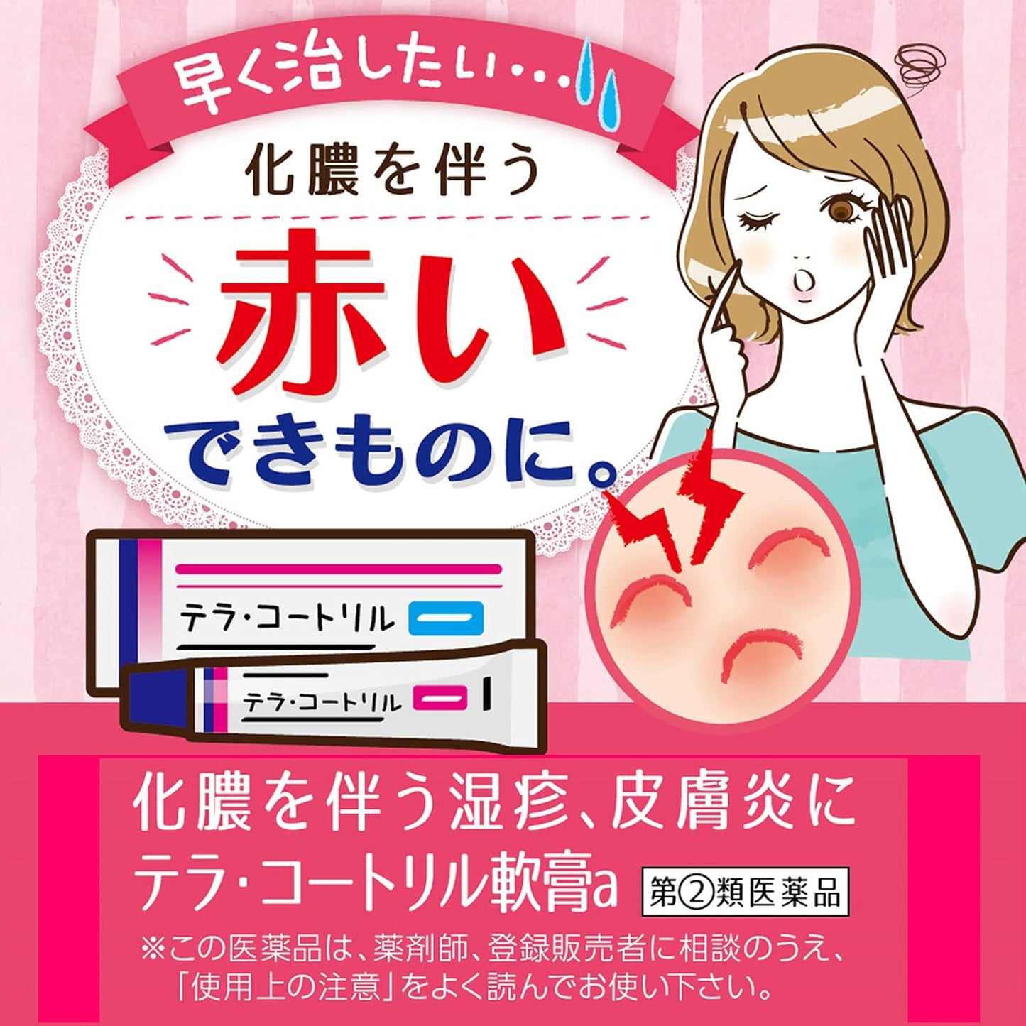 日本製 Terra-Cortril 軟膏 a 6g 包裝，專針對化膿性濕疹與皮膚炎之抗炎抗菌雙效