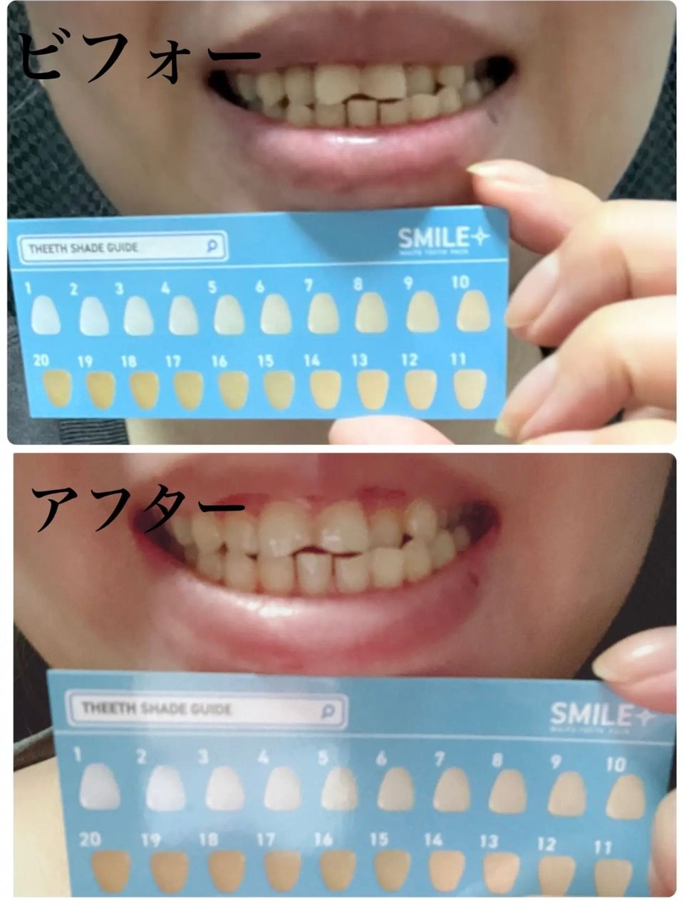 日本製：SMILE PLUS WHITE TEETH PACK 微笑亮白牙齒貼 14天用量 (B3755)
