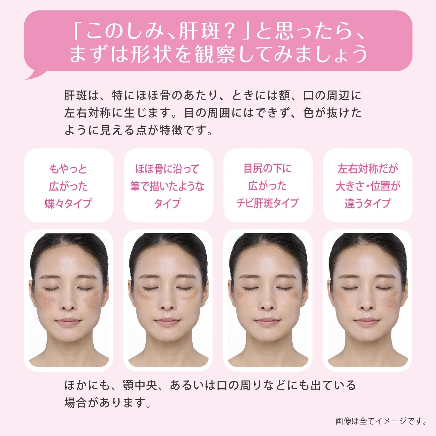 Made in Japan: Transino | EX Oral Medication for Melasma (B3482)
