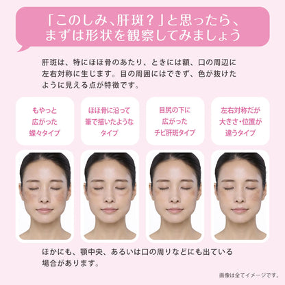 Made in Japan: Transino | EX Oral Medication for Melasma (B3482)
