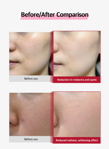 Made in Korea: Professional-grade PYDERIN Rejuvuster PDRN Pharmacy Series Regenerative Repair Cream 25ml (B3344)