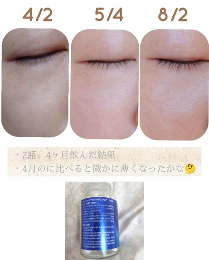 Made in Japan: TRANSINO | New Version Upgraded Blue Bottle High Concentration Spot-Removing Whitening Supplement (B3385)