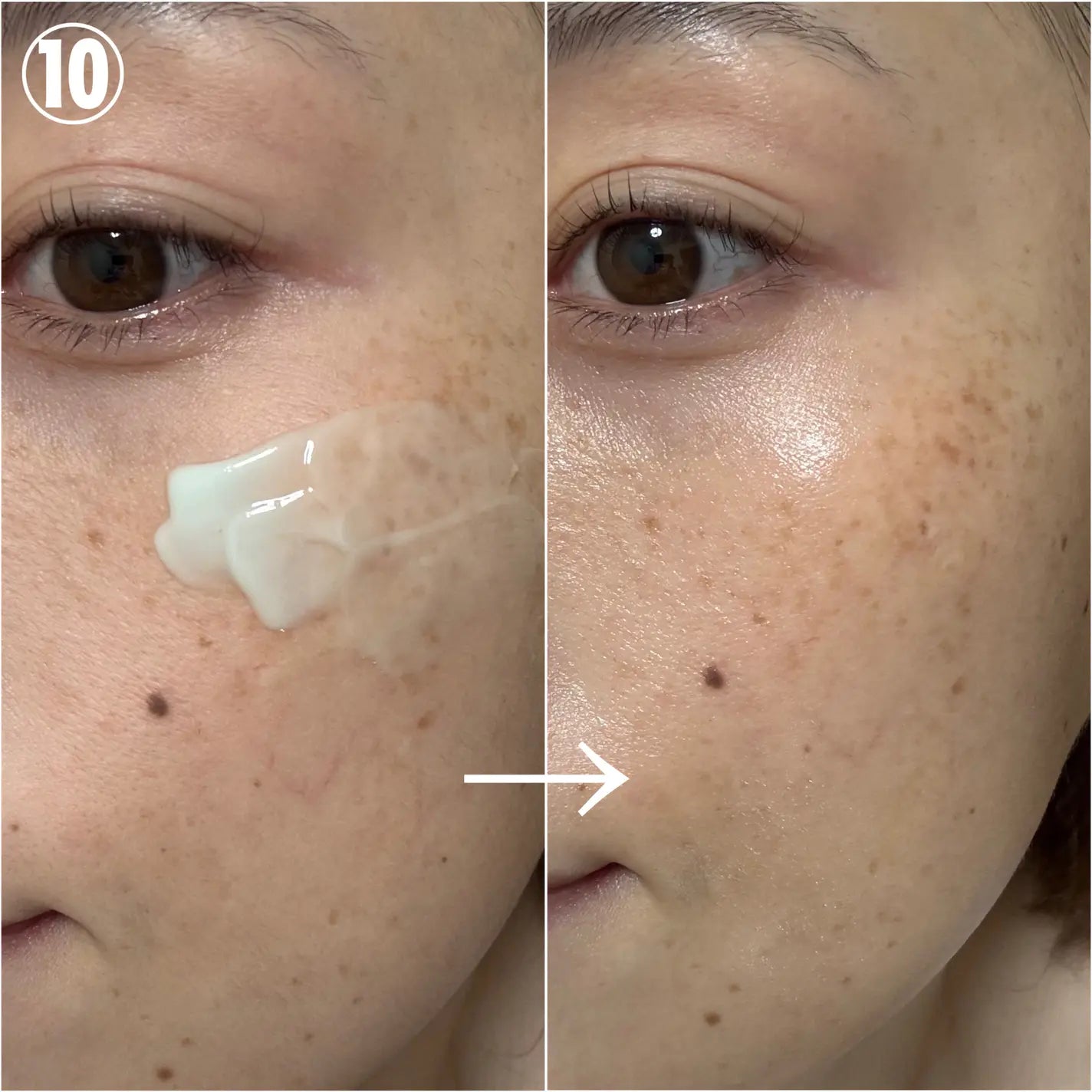 Z0440 KATAN CICA DERMA HIT SERUM 10 30g 3点セット 【公式通販】