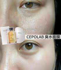 韓國製：CepoLAB 90%生物精華水 (90%臭水) 155ml (B2553)