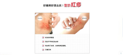 Made in Japan: Mentholatum Dermatitis & Eczema Treatment Ointment (Blue) / Cream (Red) 8g (B3234)