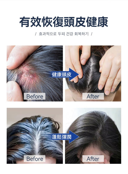 [30/8截單]韓國製：RUTHAIR 3重海鹽天然潔淨脂漏性頭皮調養洗頭水護髮素套裝 (B654)